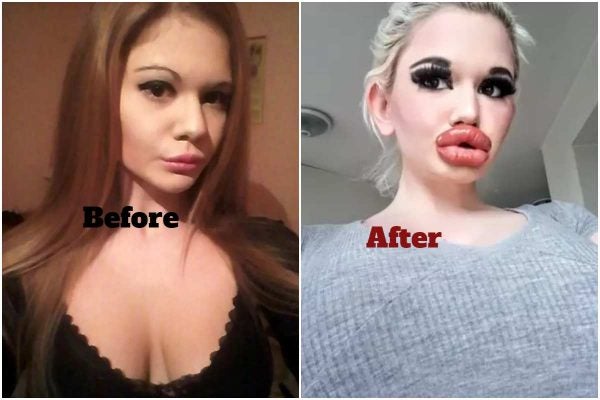 Andrea-Ivanova-Before-and-After - Novinkov.cz