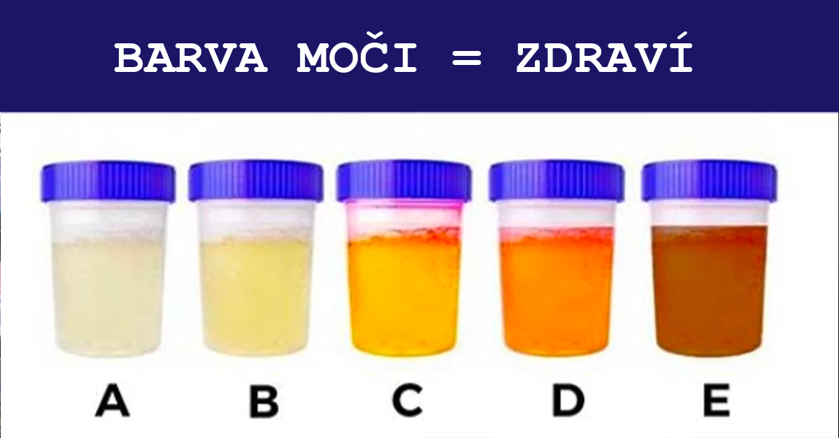 Barva Mo I Prozrazuje Kolik Vody Byste M Li Vyp T A Vys L Tak