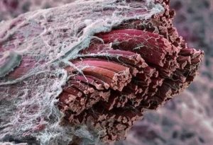 Detail svalové tkáně