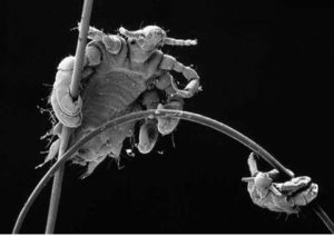 Detail vší na lidských vlasech